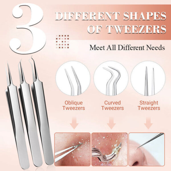 Ultimate Blackhead Extraction Tool Kit - Image 5