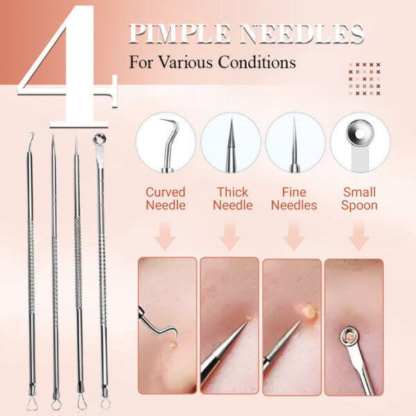 Ultimate Blackhead Extraction Tool Kit - Image 6