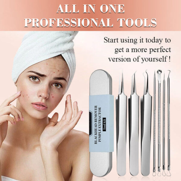 Ultimate Blackhead Extraction Tool Kit - Image 8